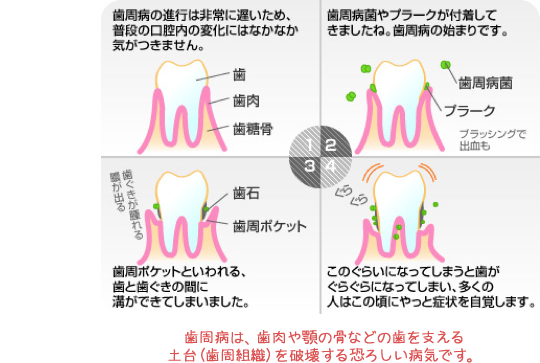 ホワイトニング前、ホワイトニング後